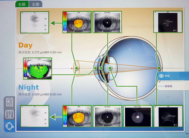 視力検査【視力1.0の見え方の質が見える】角膜形状/屈折力解析装置　OPD-Scan lll VS