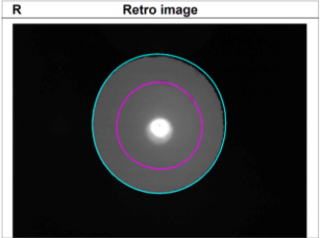 視力検査【視力1.0の見え方の質が見える】角膜形状/屈折力解析装置　OPD-Scan lll VS