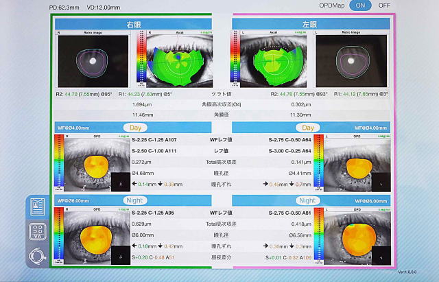 視力検査【視力1.0の見え方の質が見える】角膜形状/屈折力解析装置　OPD-Scan lll VS